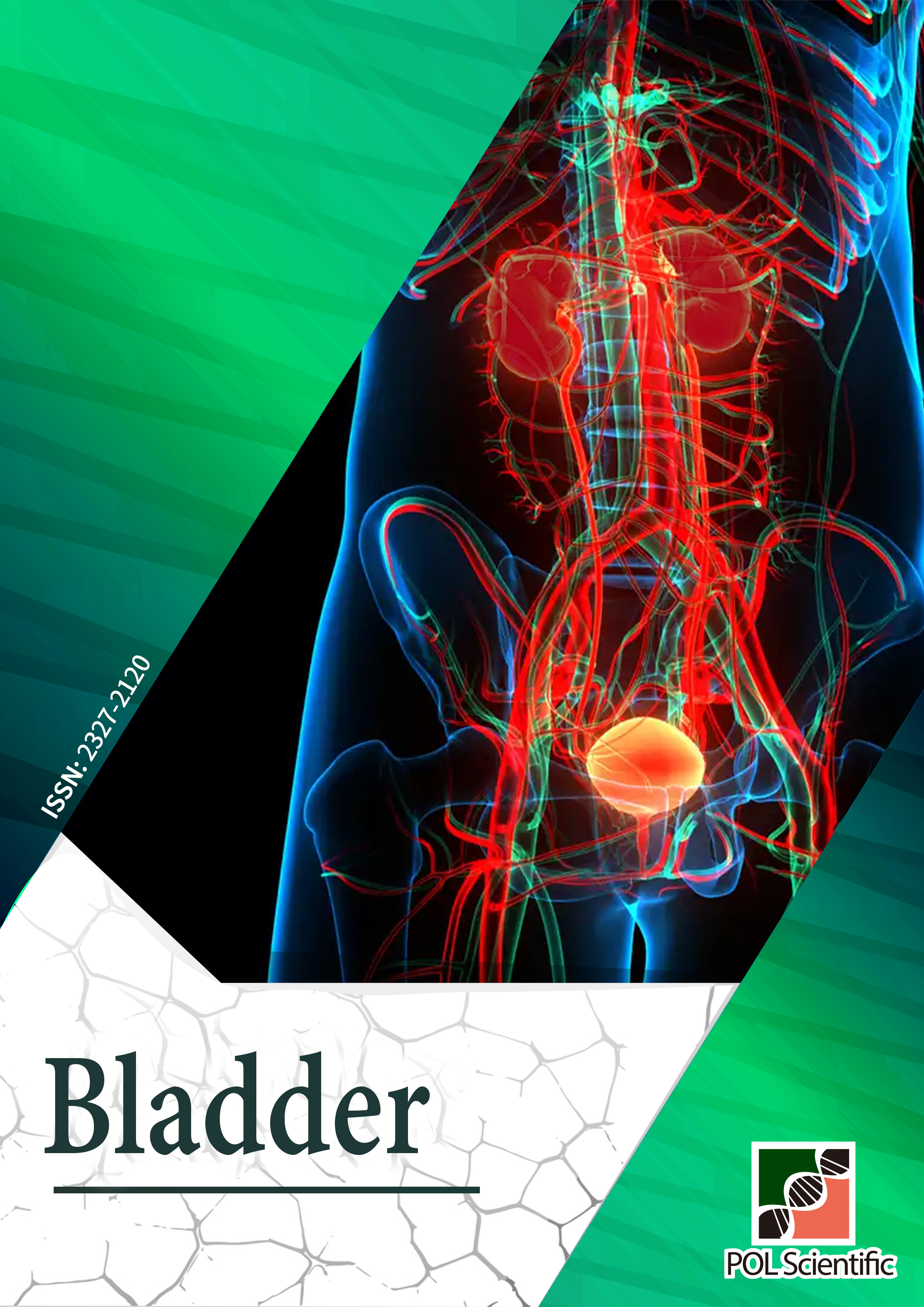 Bladder《膀胱》